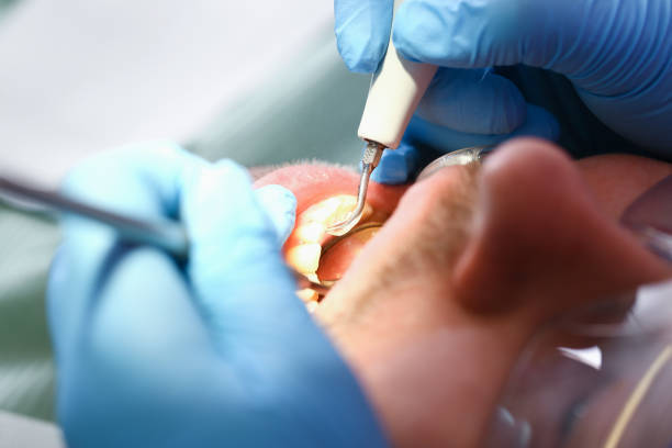 Best Urgent Dental Care for Toothache in Williamsburg, KY